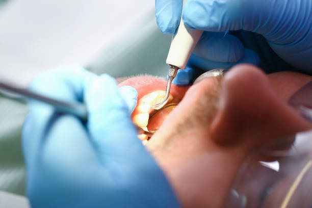 Best Emergency Broken Tooth Repair in Delft Colony, CA